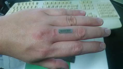 rfid chip dangerous things|nfc chip in hand.